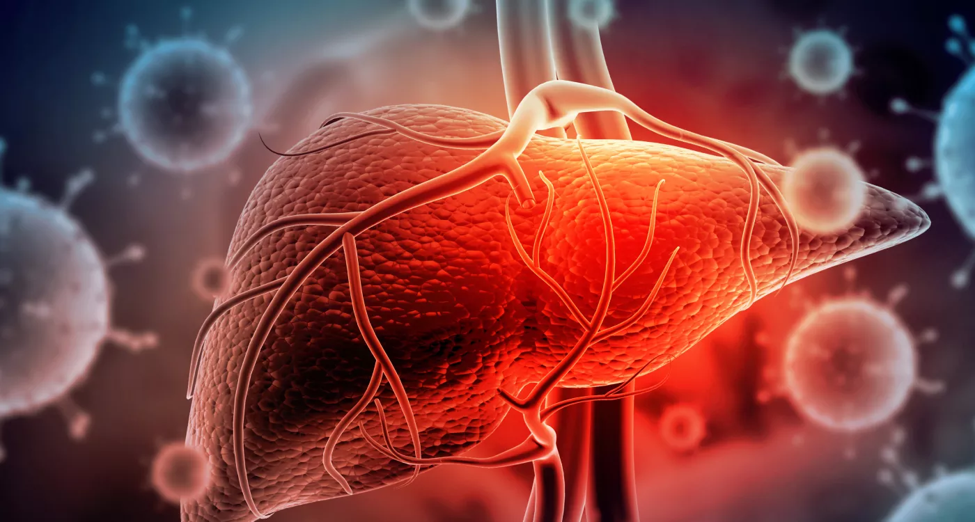 A HEPATITE E OS MALES DO FÍGADO CONCEITO DA BLANDINE                                 